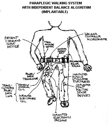 【paraplegic】什么意思_英语paraplegic的翻译_音标