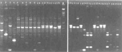 水稻条斑病菌菌株的BOX-PCR DNA指纹图谱