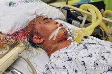 糖尿病昏迷 糖尿病昏迷