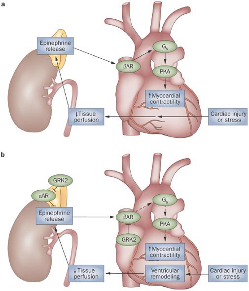 ventricular remodeling